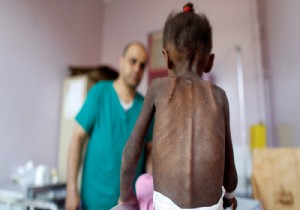 Yemen'de 20 milyon insan aç!