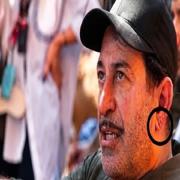 Uzman isim açıkladı: Kulak memesindeki çizgi neyin işareti?