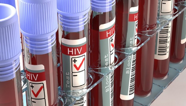 Türkiye'de HIV enfeksiyonu artıyor