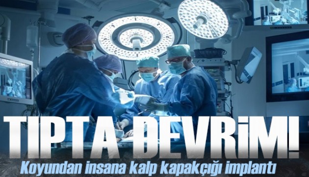 Tıpta devrim! Koyun kalp kapakçığından üretildi