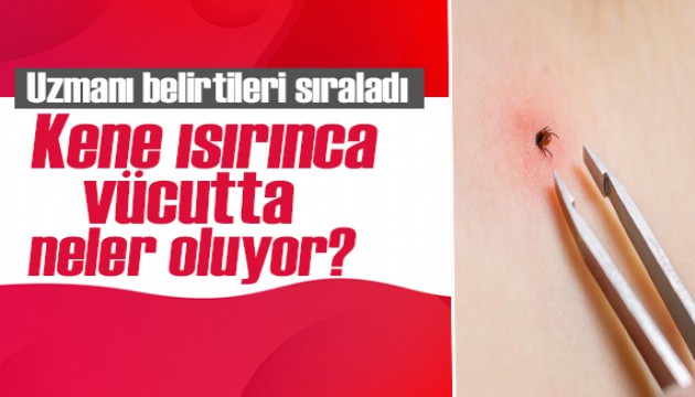 Uzmanı belirtileri sıraladı: Kene ısırınca vücutta neler oluyor?