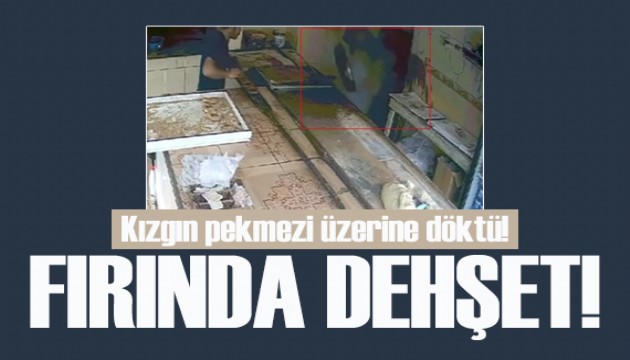 Fırında dehşet: Kızgın pekmezi başından aşağı döktü!