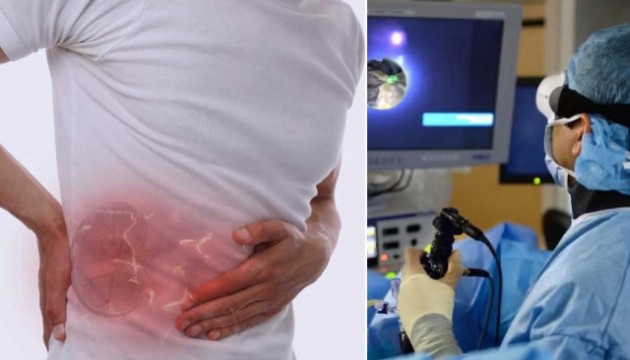 Uzman doktor sıraladı: Alışkanlıklar böbrek taşına neden oluyor