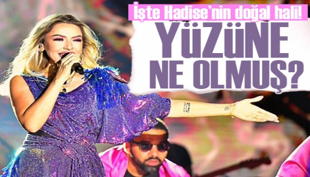 Hadise doğal haliyle sosyal medyayı salladı!