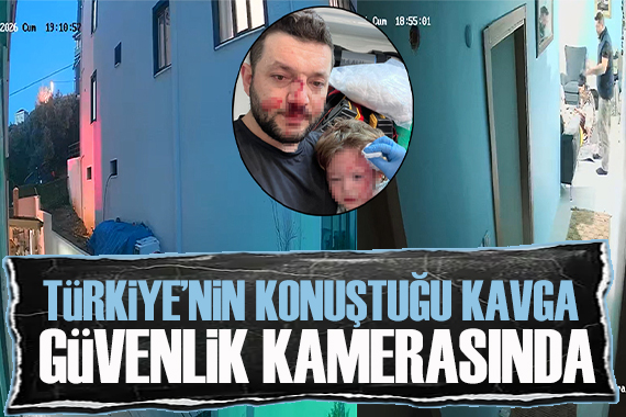 14 aylık bebeğin yaralandığı komşu kavgası güvenlik kamerasına yansıdı