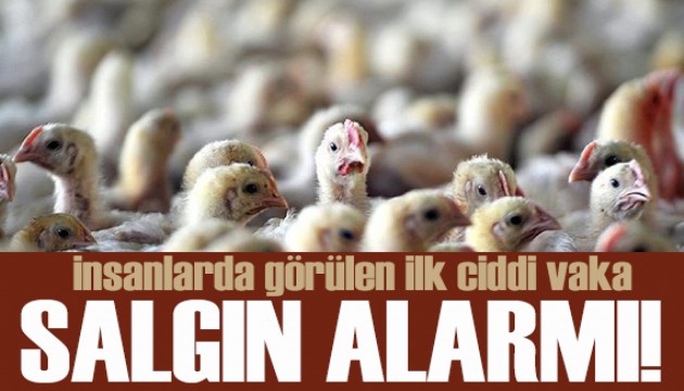 Kuş gribi alarmı! İnsanlarda görülen ilk ciddi vaka