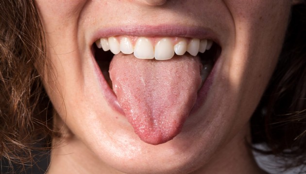 Dildeki bu işaret büyük tehlikenin habercisi