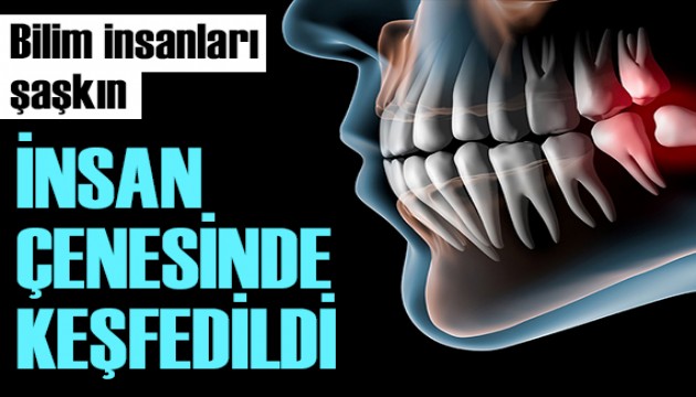 Bilim insanları şaşkın: İnsan çenesinde keşfedildi!