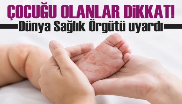 Çocuğu olanlar dikkat! Dünya Sağlık Örgütü uyardı