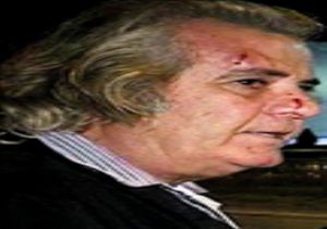 Tarık Akan’a Trafikte Gazlı Coplu Saldırı