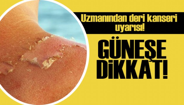 Uzmanından deri kanseri uyarısı: Güneşe dikkat!