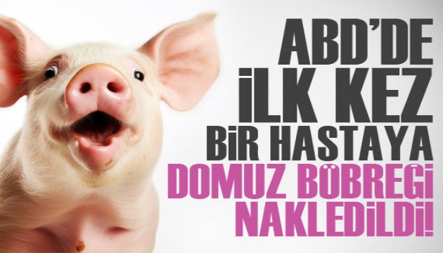 ABD'de, ilk defa bir hastaya genetiği değiştirilmiş domuz böbreği nakledildi