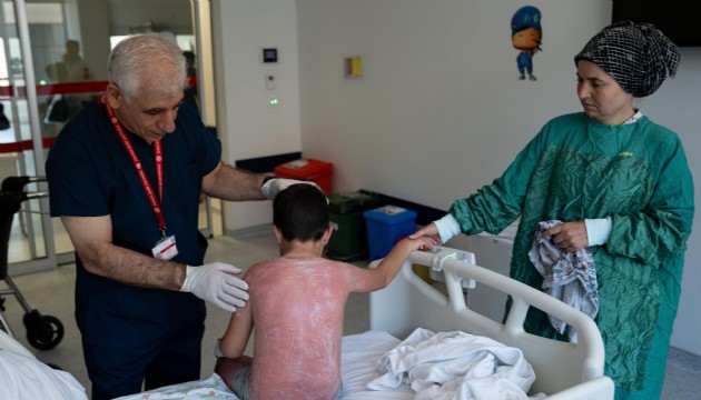 Güneşte 4 saat kalan çocuk, ikinci derece yanık oldu