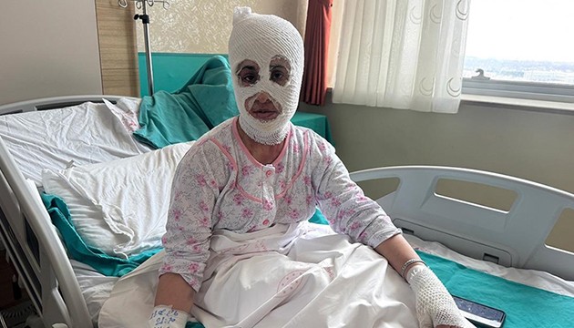 Düdüklü tencere hastanelik etti