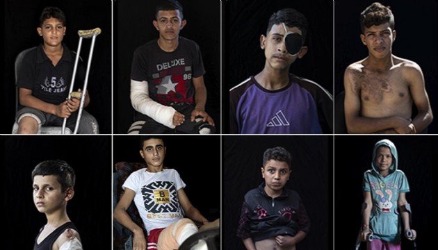 Gazze'de 5 binde fazla çocuk ampute edildi