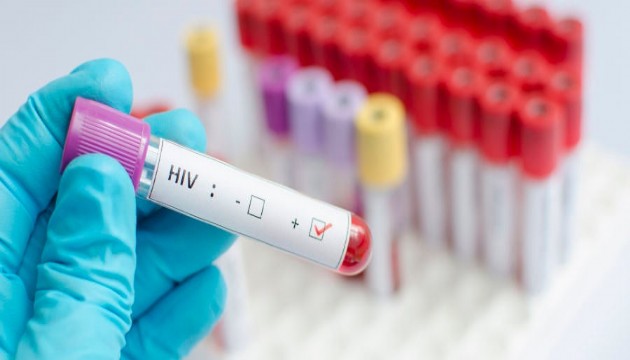 Uzmanından dikkat çeken açıklama: HIV'le yaşayan birey sayısında...