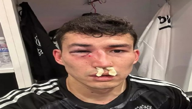 Beşiktaş'a Zaynutdinov'dan kötü haber