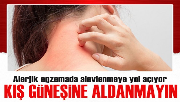 Uzman isim uyardı: Kış güneşine aldanmayın!