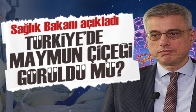 Türkiye'de 'Maymun çiçeği' görüldü mü? Sağlık Bakanı Memişoğlu'ndan açıklama