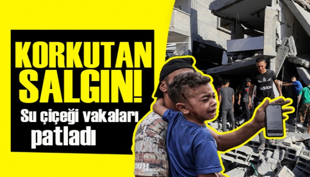 Gazze'de salgın endişesi: Su çiçeği vakaları patladı