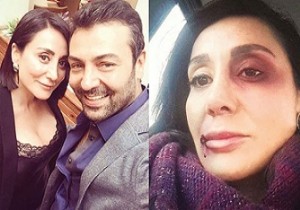 Saruhan Hünel: Beni Reklam Amaçlı Kullandı..!