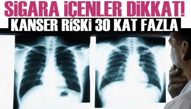 Sigara içenler dikkat! Kanser riski 30 kat daha fazla