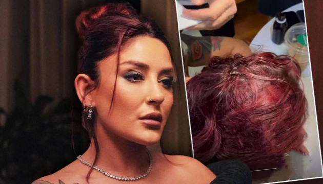 Şarkıcı Melek Mosso kafa üstü düştü: Lütfen dua edin