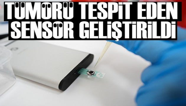 Tümörü kısa sürede tespit eden sensör geliştirildi